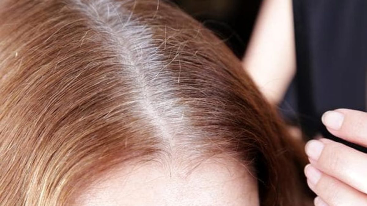 Prevenire capelli bianchi